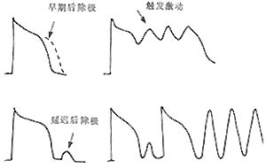 心律失常