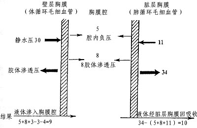 胸腔积液