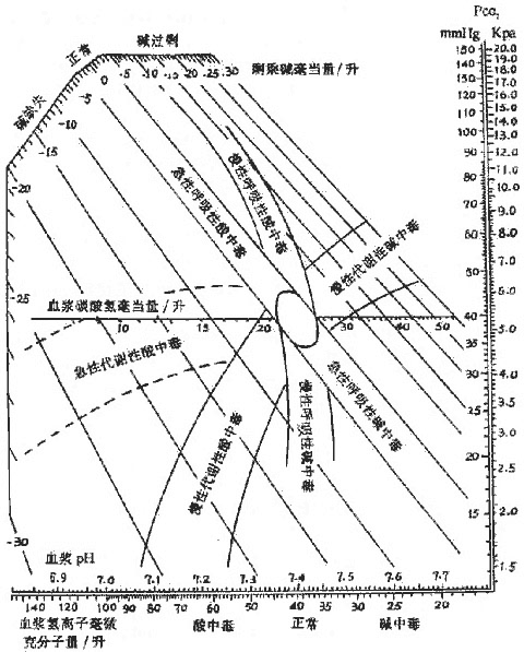 复合型酸碱失衡