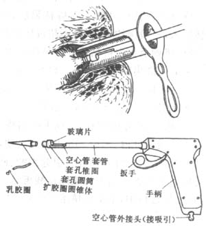 痔