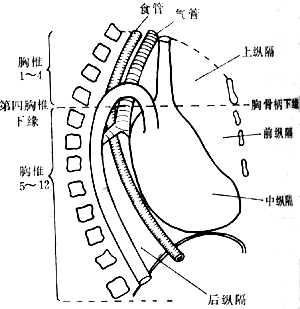 原发性纵隔肿瘤