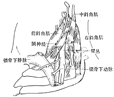 胸廓出口综合征