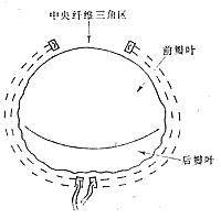 风湿性二尖瓣关闭不全