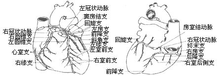 缺血性心脏病