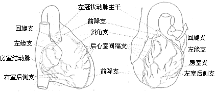 缺血性心脏病