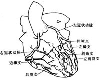 缺血性心脏病