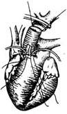 胸升主动脉动脉瘤