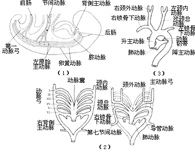 先天性主动脉弓畸形