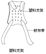 先天性髋脱位