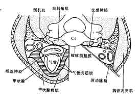 颈椎病