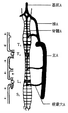 脊椎结核并发截瘫