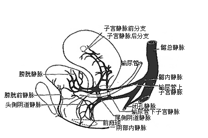 盆腔淤血综合征