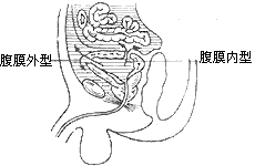 膀胱损伤