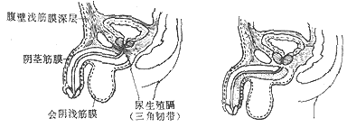 尿道损伤