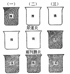 非特异性尿道炎