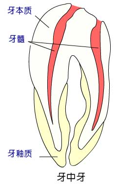 陷裂