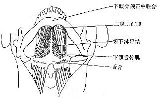 颏下间隙感染