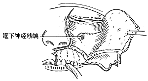 上颌窦恶性肿瘤