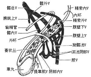 精索静脉曲张