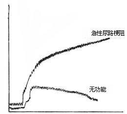 急性肾功能衰竭