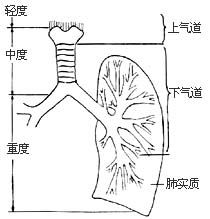 吸入性损伤