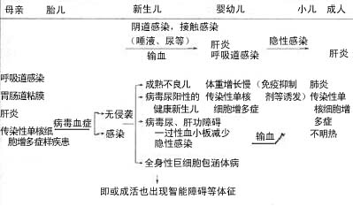 巨细胞病毒感染