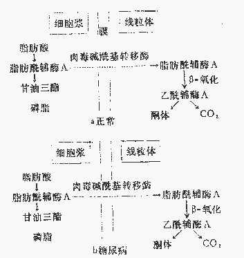 代谢性酸中毒