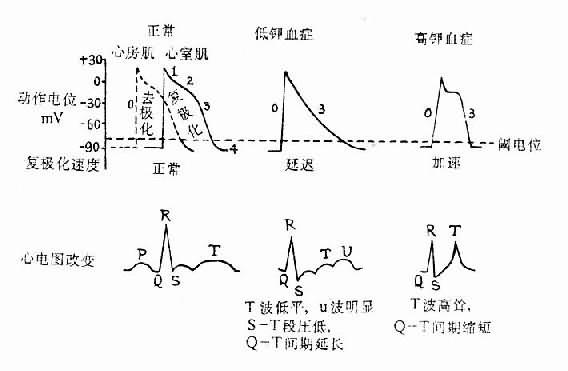 低钾血症