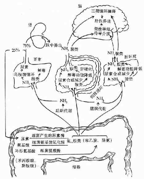 肝性脑病