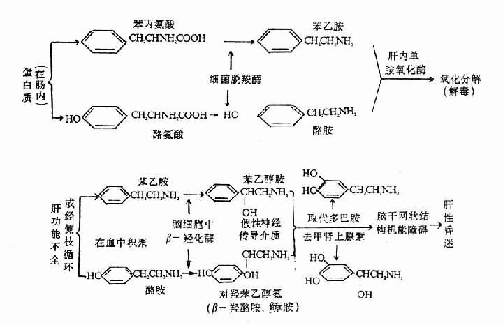 肝性脑病