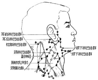 颈部淋巴结切除术图片