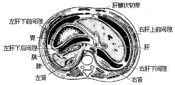 膈下脓肿切开引流术图片