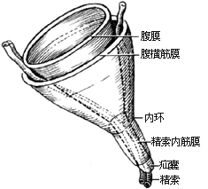 一般腹股沟斜疝修复术图片