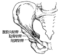 一般腹股沟斜疝修复术图片