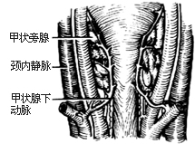 甲状旁腺切除术图片