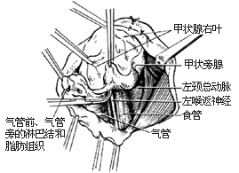 甲状旁腺切除术图片