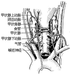 甲状腺次全切除术图片