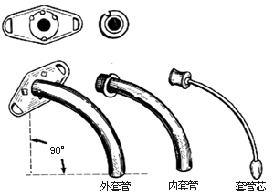 气管切开术图片