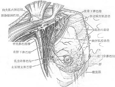 乳癌根治术图片