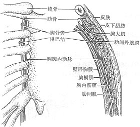 乳癌扩大根治术图片