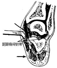 足内侧软组织松解术图片