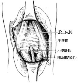 外伤性动脉瘤修复性手术图片