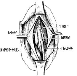 外伤性动脉瘤修复性手术图片