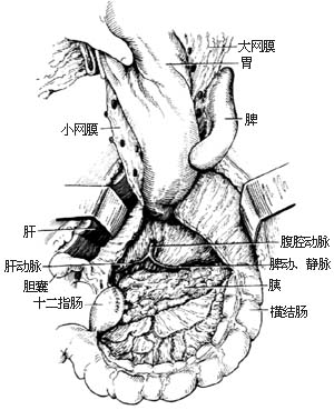 胃癌根治术图片