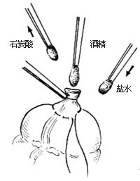 阑尾切除术图片