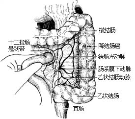 左半结肠切除术图片