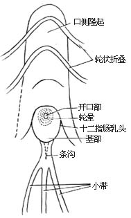 纤维十二指肠镜检查，逆行性胰胆管造影术（ERCP）及经内窥镜括约肌切开术图片