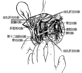 肝动脉结扎术图片