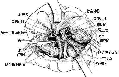 胰头、十二指肠切除术图片