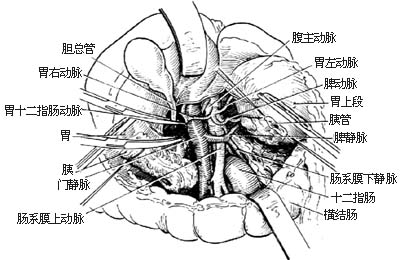 胰头、十二指肠切除术图片